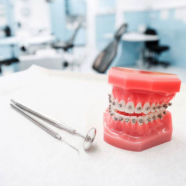 Tratamientos de ortodoncia