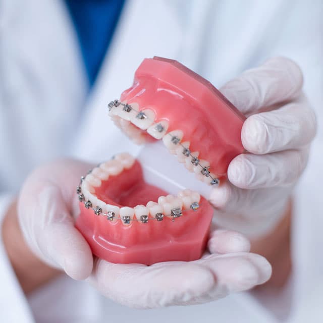 Tratamientos de ortodoncia en Ordes y Santiago