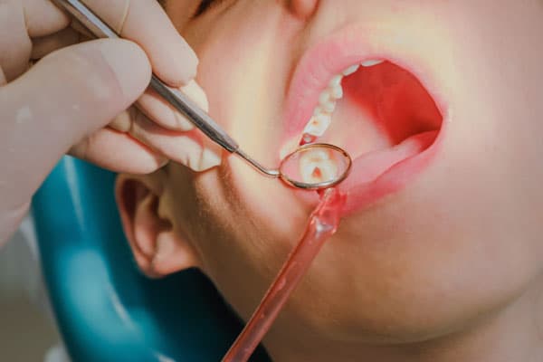 Expertos en endodoncias