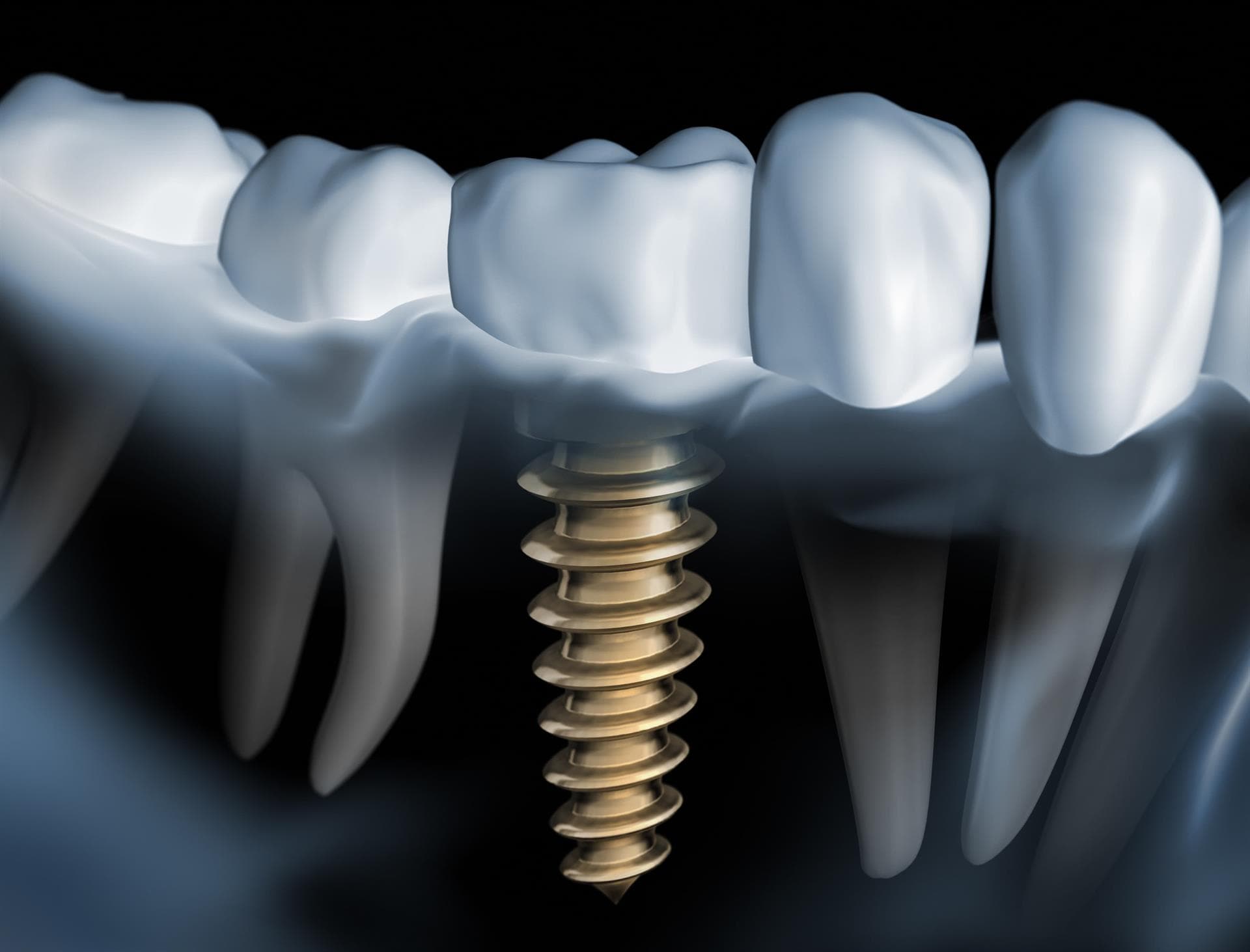 Sonrisa natural con Clínica Dental Leis