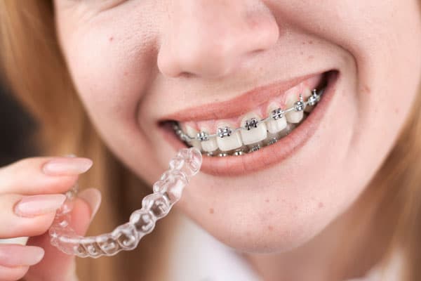 Tratamientos para adultos